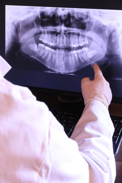 Best Emergency Broken Tooth Repair in Toluca, IL